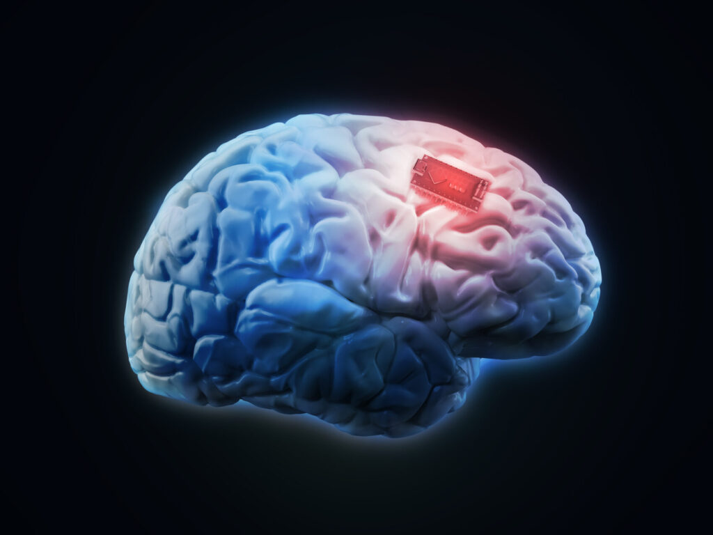 Human brain implant